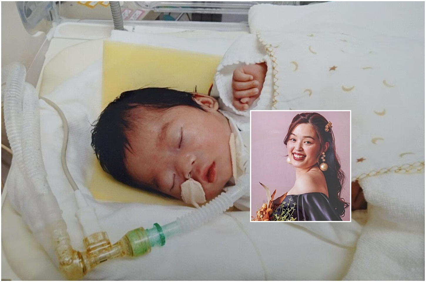 Motorista é condenada após atropelar grávida; bebê nasceu com sequelas graves em Aichi